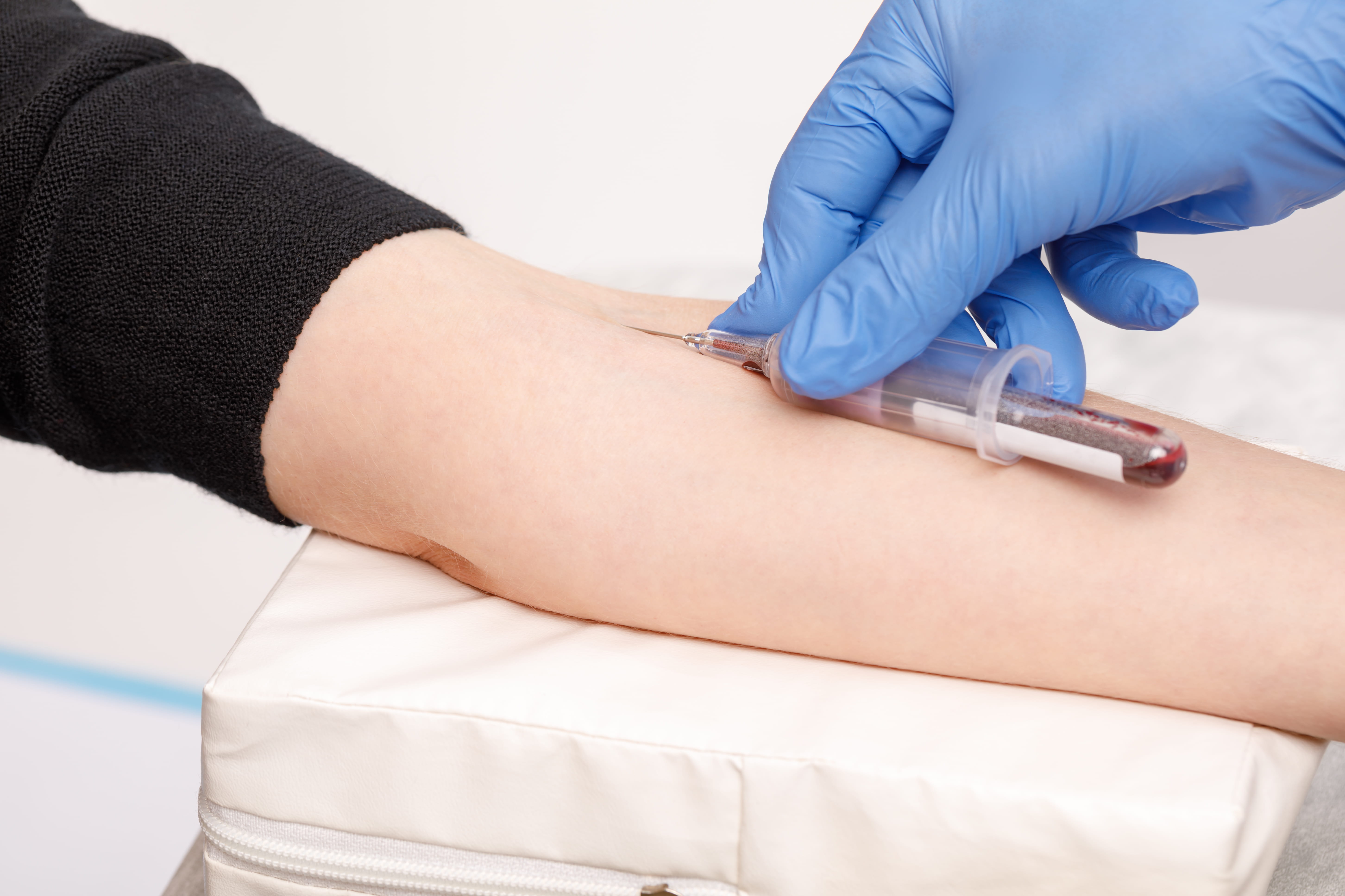 prenatal testing bloodwork